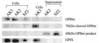 Immunoprecipitation: CD42b/GPIb alpha Antibody (AK2) - BSA Free [NB100-63790]