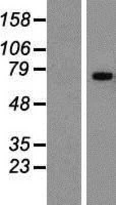 Western Blot: CD42b/GPIb alpha Overexpression Lysate [NBP2-11152]