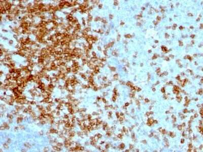 Immunohistochemistry-Paraffin: CD43/Sialophorin Antibody (84-3C1) [NBP2-44649]