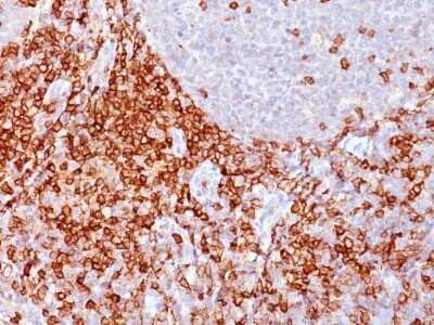 Immunohistochemistry-Paraffin: CD43/Sialophorin Antibody (Bra7G) [NBP2-44650]