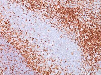 Immunohistochemistry-Paraffin: CD43/Sialophorin Antibody (SPM503) [NBP2-32822]