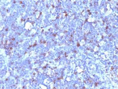 Immunohistochemistry-Paraffin: CD43/Sialophorin Antibody (SPN/1094) [NBP2-44651]