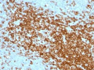 Immunohistochemistry-Paraffin: CD43/Sialophorin Antibody (SPN/1094) [NBP2-44651]