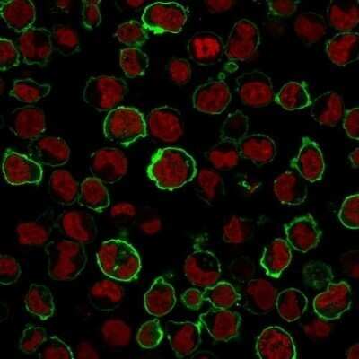 Immunocytochemistry/ Immunofluorescence: CD43/Sialophorin Antibody (SPN/1766R) - Azide and BSA Free [NBP2-54344]