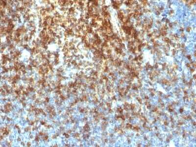 Immunohistochemistry-Paraffin: CD43/Sialophorin Antibody (SPN/1766R) [NBP2-53288]