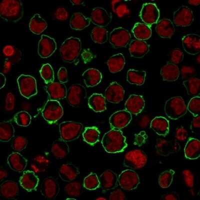 Immunocytochemistry/ Immunofluorescence: CD43/Sialophorin Antibody (SPN/2049R) [NBP3-07239]