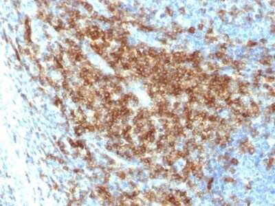Immunohistochemistry-Paraffin: CD43/Sialophorin Antibody (SPN/2049R) [NBP3-07239]