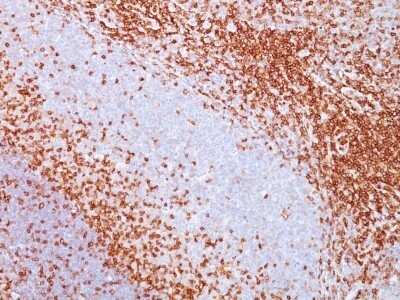 Immunohistochemistry-Paraffin: CD43/Sialophorin Antibody (SPN/839) - Azide and BSA Free [NBP2-47879]