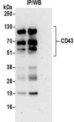 Western Blot: CD43/Sialophorin Antibody [NBP2-32115]