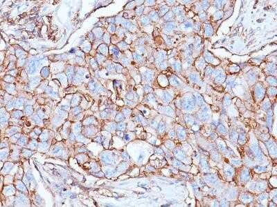 Immunohistochemistry-Paraffin: CD44 Antibody (156-3C11) - Azide and BSA Free [NBP2-34520]