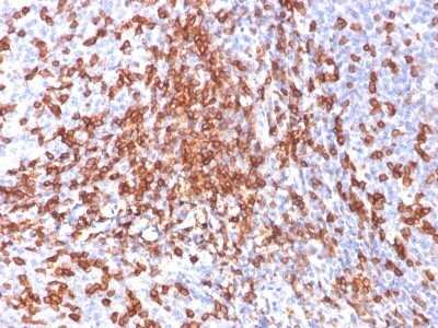 Immunohistochemistry-Paraffin: CD44 Antibody (156-3C11) - Azide and BSA Free [NBP2-34520]