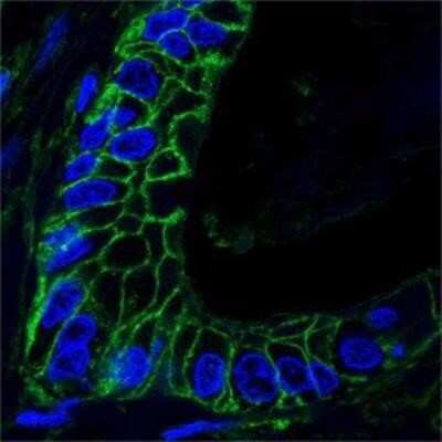 Immunocytochemistry/ Immunofluorescence: CD44 Antibody (8E2F3) - Azide and BSA Free [NBP2-80650]