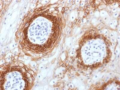 Immunohistochemistry-Paraffin: CD44 Antibody (CD44v6/1246) - variant 6 - Azide and BSA Free [NBP2-54572]