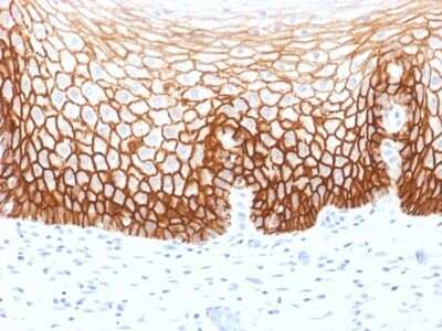 Immunohistochemistry-Paraffin: CD44 Antibody (CD44v9/1459) - variant 9 - Azide and BSA Free [NBP2-54571]