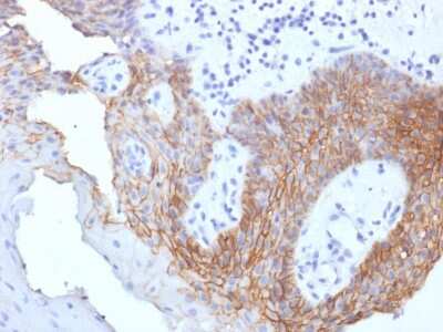 Immunohistochemistry-Paraffin: CD44 Antibody (CD44v9/1459) - variant 9 [NBP2-53204]