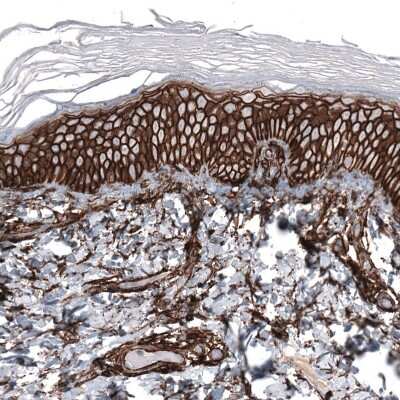 Immunohistochemistry-Paraffin: CD44 Antibody (CL13319) [NBP3-18578]