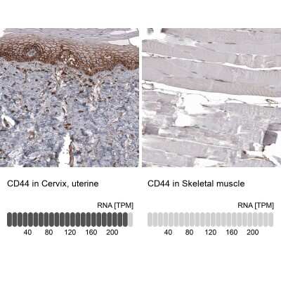 Immunohistochemistry-Paraffin: CD44 Antibody (CL13318) [NBP3-18580]