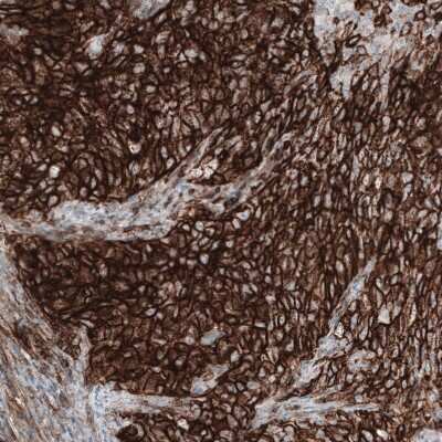 Immunohistochemistry-Paraffin: CD44 Antibody (CL13318) [NBP3-18580]
