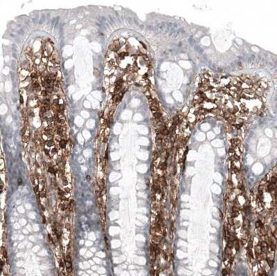 Immunohistochemistry-Paraffin: CD44 Antibody (CL13318) [NBP3-18580]