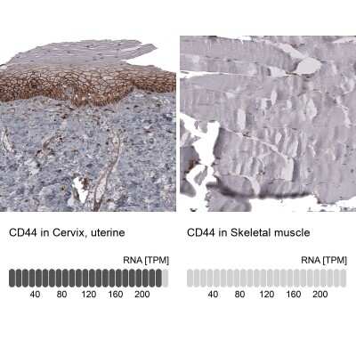 Immunohistochemistry-Paraffin: CD44 Antibody (CL13324) [NBP3-18566]