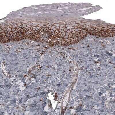 Immunohistochemistry-Paraffin: CD44 Antibody (CL13324) [NBP3-18566]