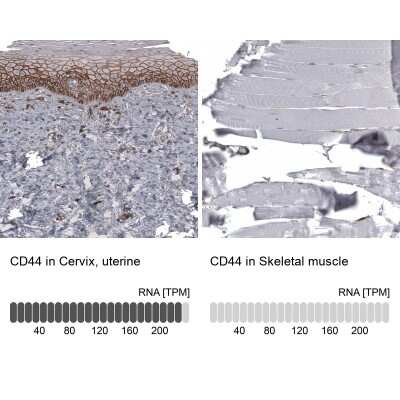 Immunohistochemistry-Paraffin: CD44 Antibody (CL13328) [NBP3-18558]
