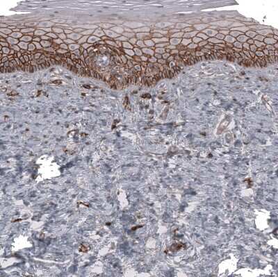 Immunohistochemistry-Paraffin: CD44 Antibody (CL13328) [NBP3-18558]