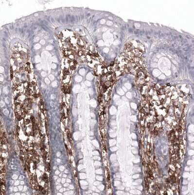 Immunohistochemistry-Paraffin: CD44 Antibody (CL13328) [NBP3-18558]