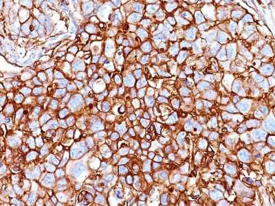 Immunohistochemistry-Paraffin: CD44 Antibody (HCAM/918) [NBP2-44652]