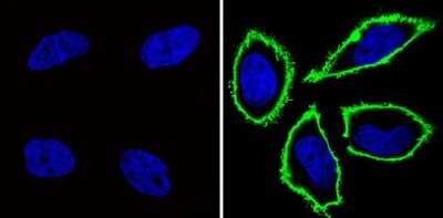 Immunocytochemistry/ Immunofluorescence: CD44 Antibody (Hermes-1) - Azide and BSA Free [NBP2-22530]