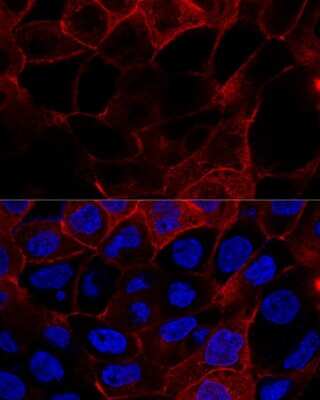 Immunocytochemistry/ Immunofluorescence: CD44 Antibody - Azide and BSA Free [NBP2-92947]