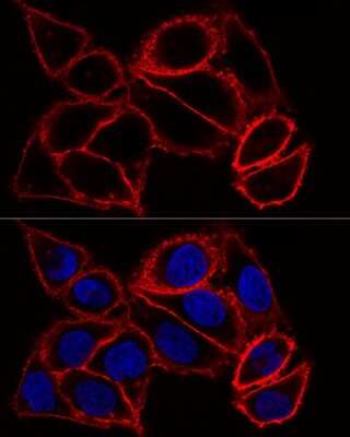 Immunocytochemistry/ Immunofluorescence: CD44 Antibody - Azide and BSA Free [NBP2-92947]