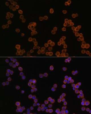 Immunocytochemistry/ Immunofluorescence: CD44 Antibody - Azide and BSA Free [NBP2-92947]