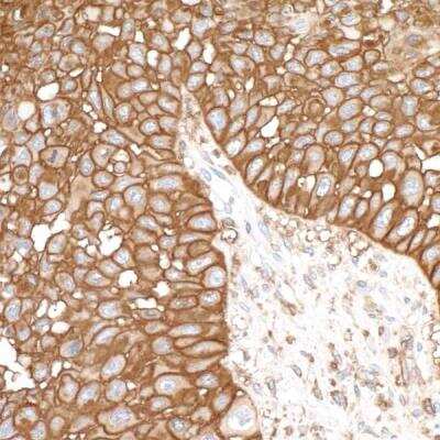 Immunohistochemistry-Paraffin: CD44 Antibody (BLR038F) [NBP3-14671]