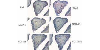 Immunohistochemistry: CD44 Antibody (VFF-17) - variant 7/8 - Azide and BSA Free [NB100-65535]