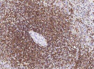 Immunohistochemistry-Paraffin: CD45 Antibody (101) [NBP2-89218]