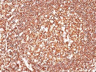 Immunohistochemistry-Paraffin: CD45 Antibody (135-4C5) [NBP2-44863]