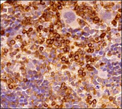 Immunohistochemistry-Paraffin: CD45 Antibody (30-F11) - BSA Free [NB100-77417]