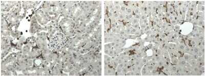 Immunohistochemistry: CD45 Antibody (5C16) - Azide and BSA Free [NB110-93609]