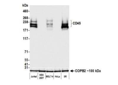 Western Blot: CD45 Antibody (BL-178-12C7) [NBP3-14668]