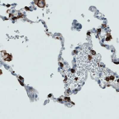 Immunohistochemistry-Paraffin: CD45 Antibody (CL0159) [NBP2-52868]