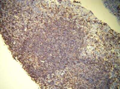 Immunohistochemistry-Paraffin: CD45 Antibody (E19-G) [NBP1-30145]