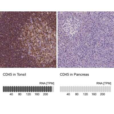 Immunohistochemistry-Paraffin: CD45 Antibody [NBP1-88103]