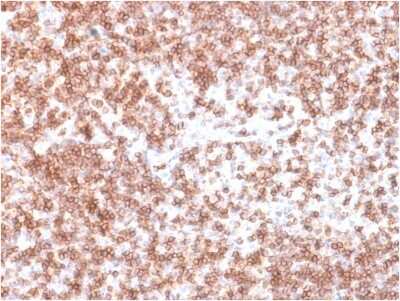 Immunohistochemistry-Paraffin: CD45 Antibody (PTPRC/1975R) - Azide and BSA Free [NBP3-08910]