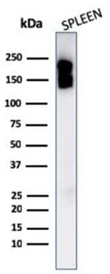 Western Blot: CD45 Antibody (PTPRC/1975R) [NBP3-07167]
