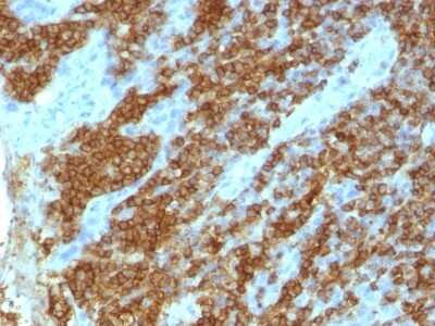 Immunohistochemistry-Paraffin: CD45RA Antibody (111-1C5) [NBP2-44861]