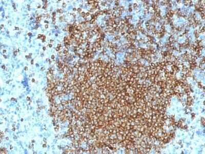 Immunohistochemistry-Paraffin: CD45RA Antibody (K4B5) - Azide and BSA Free [NBP3-08901]