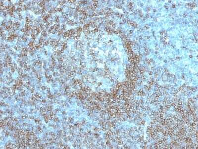 Immunohistochemistry-Paraffin: CD45RA Antibody (K4B5) [NBP3-07159]