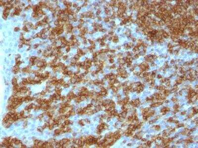 Immunohistochemistry-Paraffin: CD45RA Antibody (PTPRC/1131) - IHC-Prediluted [NBP2-48450]