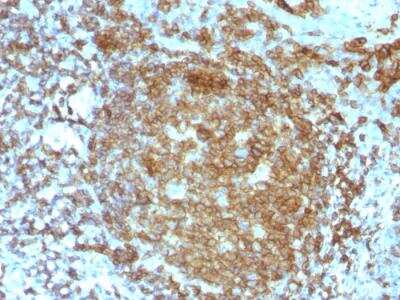 Immunohistochemistry-Paraffin: CD45RA Antibody (PTPRC/818) - IHC-Prediluted [NBP2-48441]